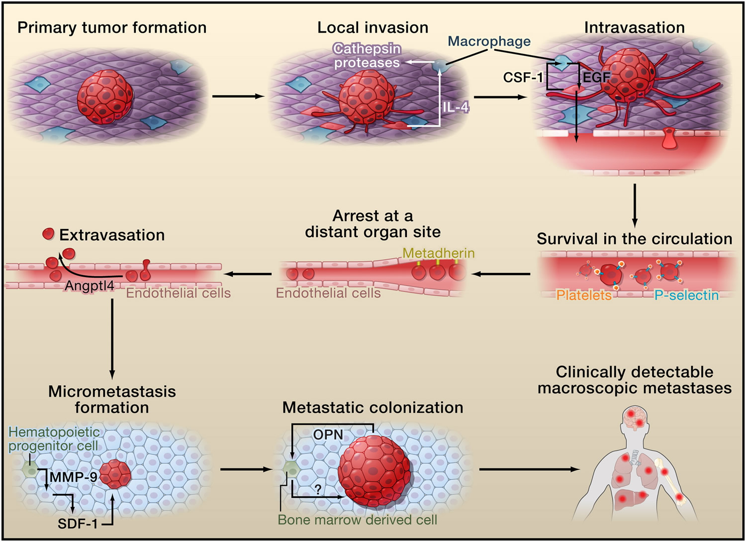 Why Does Cancer Metastasize