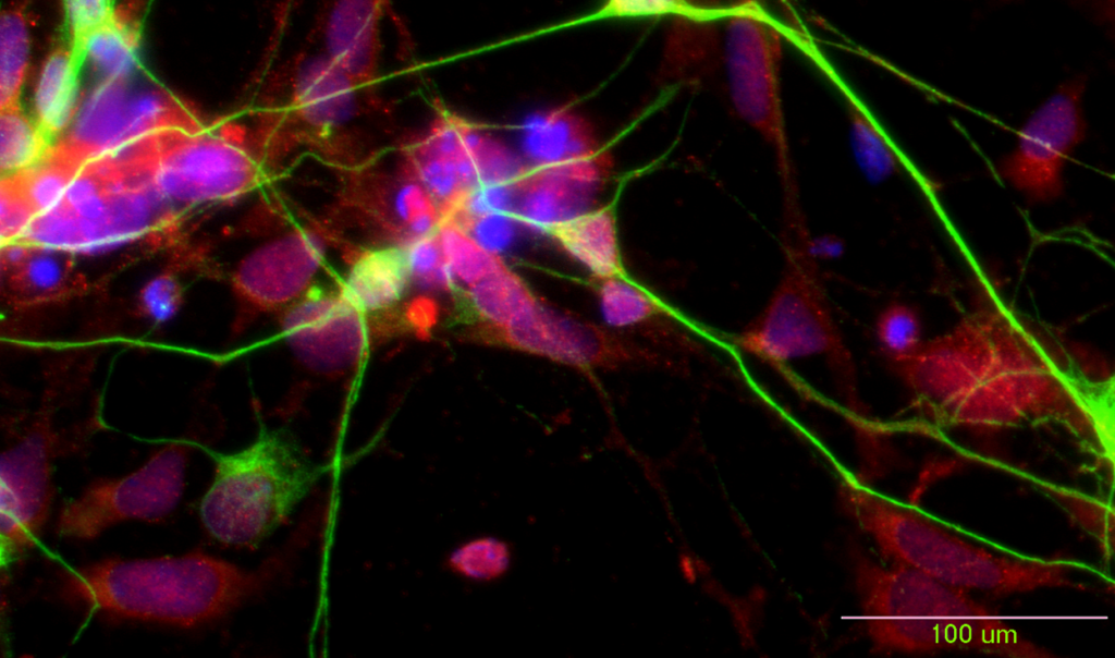 Duke University Marcus Center for Cellular Cures